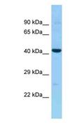 CCR10 / GPR2 Antibody - CCR10 / GPR2 antibody Western Blot of Fetal Liver. Antibody dilution: 1 ug/ml.  This image was taken for the unconjugated form of this product. Other forms have not been tested.