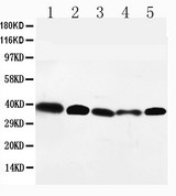 CCR10 / GPR2 Antibody - WB of CCR10 / GPR2 antibody. All lanes: Anti-CCR10 at 0.5ug/ml. Lane 1: HELA Whole Cell Lysate at 40ug. Lane 2: SW620 Whole Cell Lysate at 40ug. Lane 3: A549 Whole Cell Lysate at 40ug. Lane 4: MM231 Whole Cell Lysate at 40ug. Lane 5: SMMC Whole Cell Lysate at 40ug. Predicted bind size: 38KD. Observed bind size: 38KD.