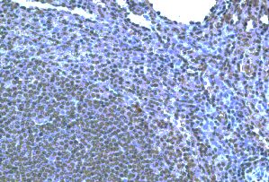 CCR10 / GPR2 Antibody - Immunohistochemistry of paraffin-embeddedi human spleen stained with Goat anti-Human CCR10