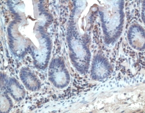CCR10 / GPR2 Antibody - Immunohistochemistry of paraffin-embeddedi human tonsil stained with Goat anti-Human CCR10
