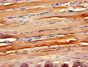 CCR10 / GPR2 Antibody - Immunohistochemistry of paraffin-embedded human skeletal muscle tissue at dilution of 1:100