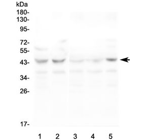 CCR10 / GPR2 Antibody - Western blot testing of human 1) HeLa, 2) K562, 3) PC-3, 4) A549 and 5) T-47D lysate with CCR10 antibody at 0.5ug/ml. Predicted molecular weight ~38 kDa.