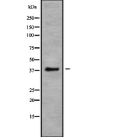 CCR10 / GPR2 Antibody - Western blot analysis of CCR10 using COLO205 whole cells lysates