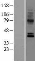 CCR10 / GPR2 Protein - Western validation with an anti-DDK antibody * L: Control HEK293 lysate R: Over-expression lysate
