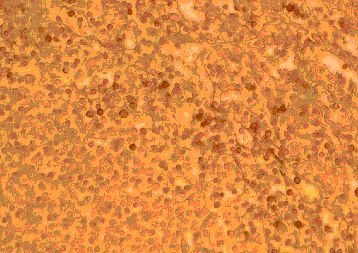 CCR2 Antibody - Immunohistochemistry of paraffin-embeddedi human spleen stained with Goat anti-Human CD192 (N-Terminal)