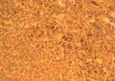 CCR2 Antibody - Immunohistochemistry of paraffin-embeddedi human spleen stained with Goat anti-Human CD192 (N-Terminal)