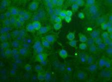 CCR2 Antibody - CCR2 Antibody - Immunocytochemical analysis of CCR2 in HeLa cells.  This image was taken for the unconjugated form of this product. Other forms have not been tested.