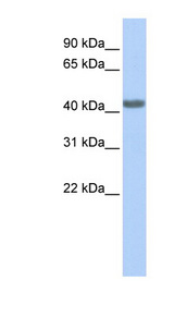 CCR2 Antibody - CCR2 antibody Western blot of 721_B cell lysate. This image was taken for the unconjugated form of this product. Other forms have not been tested.
