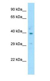 CCR2 Antibody - CCR2 antibody Western Blot of Human Thymus.  This image was taken for the unconjugated form of this product. Other forms have not been tested.