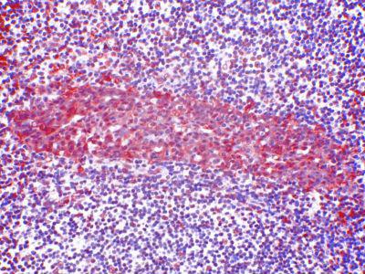 CCR2 Antibody - Clone 7A7 human tonsil paraffin section