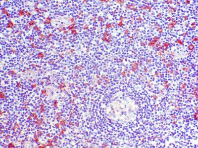 CCR2 Antibody - Clone A7A human tonsil paraffin section