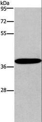 CCR2 Antibody - Western blot analysis of Mouse skin tissue, using CCR2 Polyclonal Antibody at dilution of 1:450.