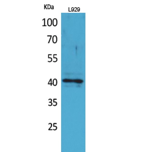 CCR3 Antibody - Western blot of CKR-3 antibody