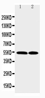 CCR3 Antibody - WB of CCR3 antibody. Lane 1: K562 Cell Lysate. Lane 2: RAJI Cell Lysate.