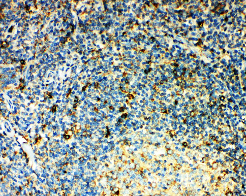 CCR3 Antibody - CCR3 antibody. IHC(P): Human Tonsil Tissue.