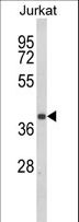 CCR3 Antibody - Western blot of CCR3 Antibody in Jurkat cell line lysates (35 ug/lane). CCR3 (arrow) was detected using the purified antibody.
