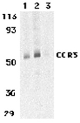 CCR3 Antibody - Western blot analysis on normal human spleen lysate probed with Rabbit anti-Human CD193 (RABBIT ANTI HUMAN CD193).