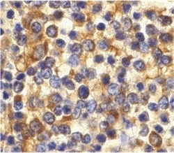 CCR3 Antibody - IHC of normal human spleen with Rabbit anti-Human CD193 (RABBIT ANTI HUMAN CD193).
