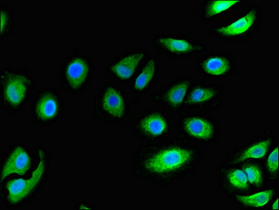 CCR3 Antibody - Immunofluorescent analysis of A549 cells diluted at 1:100 and Alexa Fluor 488-congugated AffiniPure Goat Anti-Rabbit IgG(H+L)