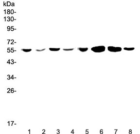 CCR3 Antibody - Western blot testing of human 1) Jurkat, 2) HepG2, 3) MCF7, 4) U-87 MG, 5) CCRF-CEM, 6) rat brain, 7) mouse brain and 8) mouse testis lysate wtih CCR3 antibody at 0.5ug/ml. Expected molecular weight: 40~55 kDa.