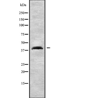 CCR3 Antibody - Western blot analysis of CCR3 using 293 whole cells lysates