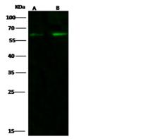 CCR3 Antibody - Anti-CD193 rabbit polyclonal antibody at 1:500 dilution. Lane A: Daudi Whole Cell Lysate. Lane B: K562 Whole Cell Lysate. Lysates/proteins at 30 ug per lane. Secondary: Goat Anti-Rabbit IgG H&L (Dylight 800) at 1/10000 dilution. Developed using the Odyssey technique. Performed under reducing conditions. Predicted band size: 43 kDa. Observed band size: 62 kDa.