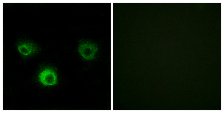 CCR4 Antibody - Immunofluorescence analysis of HUVEC cells, using CCR4 Antibody. The picture on the right is blocked with the synthesized peptide.