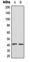 CCR4 Antibody - Western blot analysis of CCR4 expression in HL60 (A); MCF7 (B) whole cell lysates.