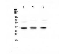 CCR4 Antibody - Western blot analysis of CCR4 using anti-CCR4 antibody