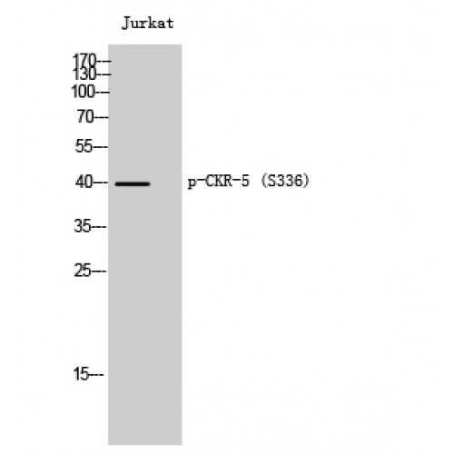 CCR5 Antibody - Western blot of Phospho-CKR-5 (S336) antibody