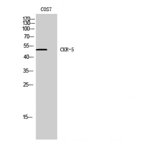CCR5 Antibody - Western blot of CKR-5 antibody