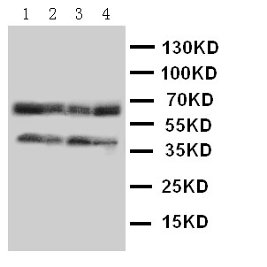 CCR5 Antibody - CCR5 antibody Western blot. Lane 1: COLO320 Cell Lysate. Lane 2: MCF-7 Cell Lysate. Lane 3: SMMC Cell Lysate. Lane 4: JURKAT Cell Lysate.