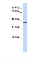 CCR5 Antibody - Fetal heart lysate. Antibody concentration: 1.0 ug/ml. Gel concentration: 12%.  This image was taken for the unconjugated form of this product. Other forms have not been tested.