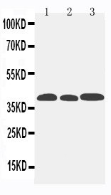 CCR5 Antibody - CCR5 antibody Western blot. Lane 1: Mouse Lung Tissue Lysate. Lane 2: Mouse Intestine Tissue Lysate. Lane 3: Mouse Kidney Tissue Lysate.