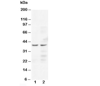 CCR5 Antibody - Western blot testing of CCR5 antibody and Lane 1: Jurkat; 2: COLO320 cell lysate