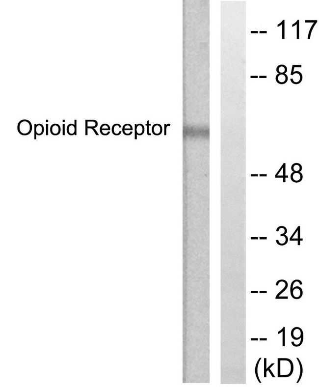 CCR5 Antibody - Western blot analysis of lysates from COS7 cells, using CCR5 Antibody. The lane on the right is blocked with the synthesized peptide.