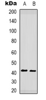 CCR5 Antibody - Western blot analysis of CCR5 (pS349) expression in HeLa (A); Raw264.7 (B) whole cell lysates.