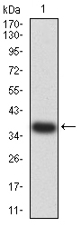 CCR5 Antibody - Western blot analysis using CD195 mAb against human CD195 (AA: extra mix) recombinant protein. (Expected MW is 36.7 kDa)