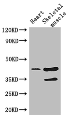 CCR5 Antibody - Positive WB detected in:Mouse heart tissue,Mouse skeletal muscle tissue;All lanes: Ccr5 antibody at 3ug/ml;Secondary;Goat polyclonal to rabbit IgG at 1/50000 dilution;Predicted band size: 41 kDa;Observed band size: 41,35 kDa;
