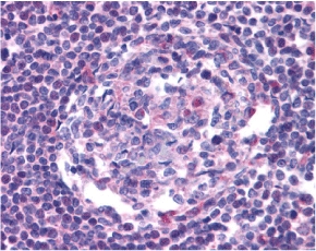 CCR5 Antibody - Immunohistochemistry of CCR5 in human lymph node tissue with CCR5 antibody at 20 ug/ml.
