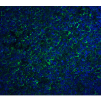 CCR5 Antibody - Immunofluorescence of CCR5 in human lymph node tissue with CCR5 antibody at 20 µg/mL.Green: CCR5 Antibody  Blue: DAPI staining