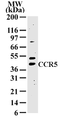 CCR5 Antibody - Western blot of 10 ug of total cell lysate from MCF-7 cells with antibody at 2 ug/ml dilution