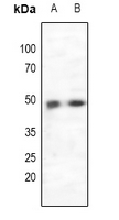 CCR5 Antibody - Western blot analysis of CCR5 expression in K562 (A), MCF7 (B) whole cell lysates.
