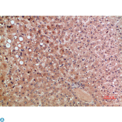 CCR5 Antibody - Immunohistochemical analysis of paraffin-embedded human-liver, antibody was diluted at 1:200.