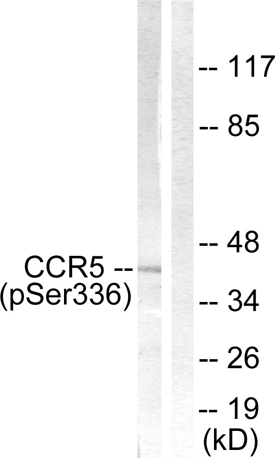 CCR5 Antibody - Western blot analysis of lysates from Jurkat cells, using CCR5 (Phospho-Ser336) Antibody. The lane on the right is blocked with the phospho peptide.