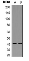 CCR5 Antibody - Western blot analysis of CCR5 (pS336) expression in Jurkat (A); mouse mammary tumor (B) whole cell lysates.