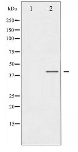 CCR5 Antibody - Western blot of CCR5 phosphorylation expression in Jurkat whole cell lysates,The lane on the left is treated with the antigen-specific peptide.