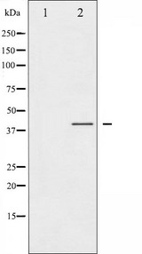 CCR5 Antibody - Western blot analysis of CCR5 phosphorylation expression in Jurkat whole cells lysates. The lane on the left is treated with the antigen-specific peptide.