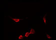 CCR5 Antibody - Staining HeLa cells by IF/ICC. The samples were fixed with PFA and permeabilized in 0.1% Triton X-100, then blocked in 10% serum for 45 min at 25°C. The primary antibody was diluted at 1:200 and incubated with the sample for 1 hour at 37°C. An Alexa Fluor 594 conjugated goat anti-rabbit IgG (H+L) Ab, diluted at 1/600, was used as the secondary antibody.