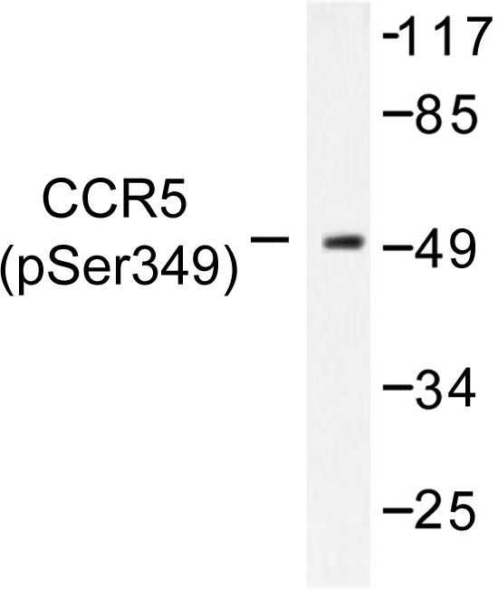 CCR5 Antibody - Western blot of p-CKR-5 (S349) pAb in extracts from HeLa cells treated with PMA.